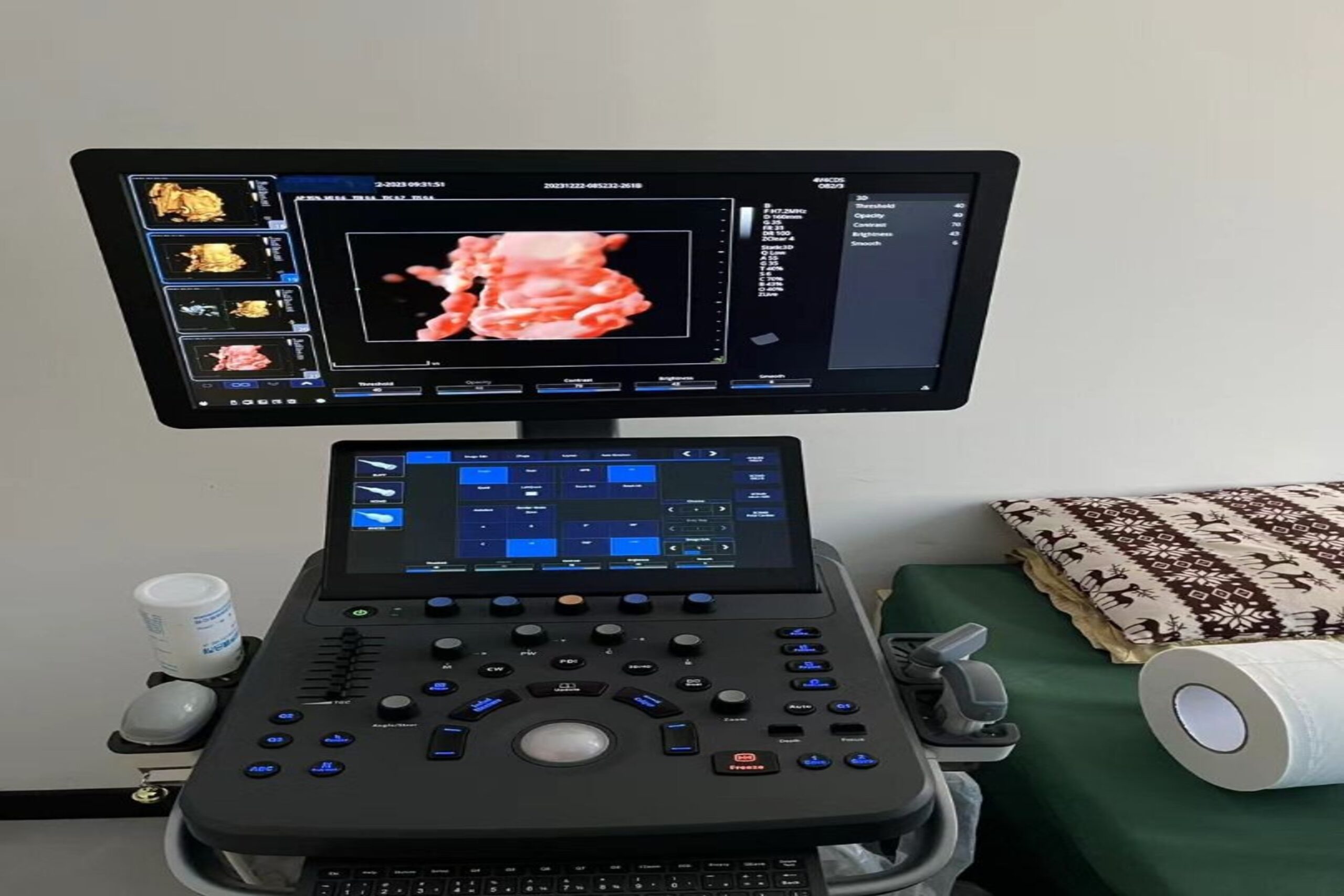 EKG/Cardiac Echo and X-Ray